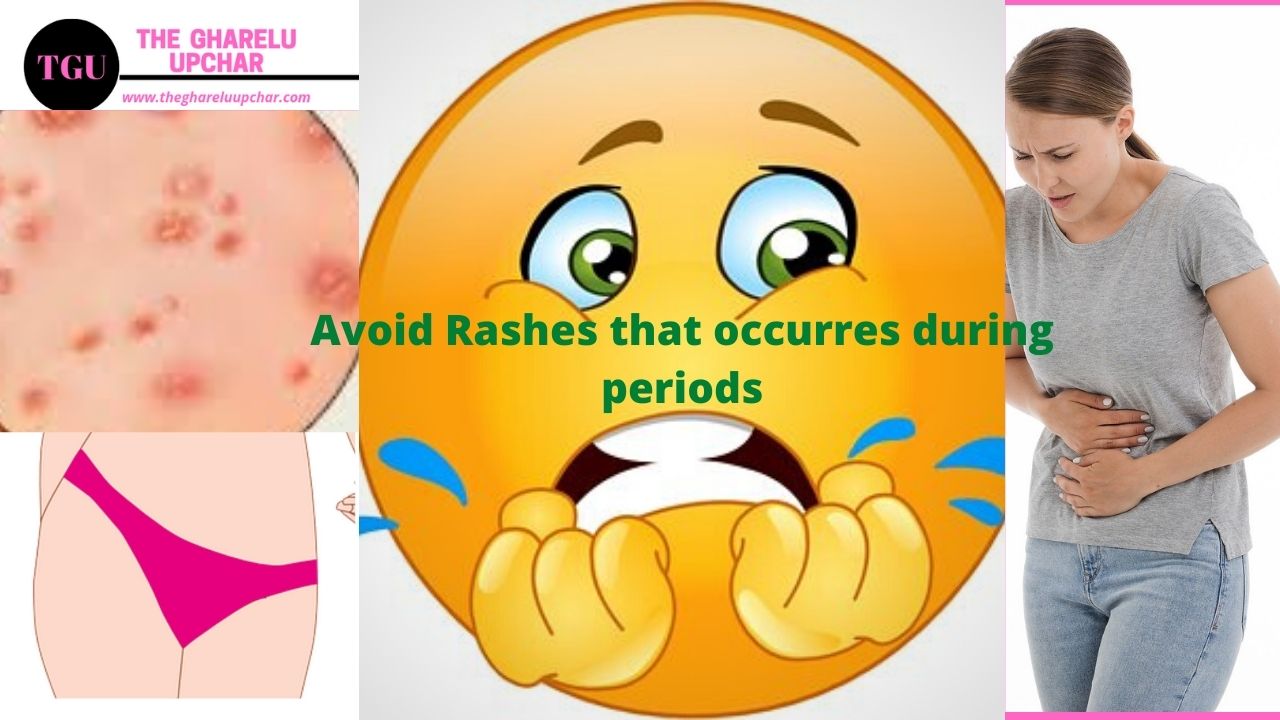 How to get comfortable with Sanitary Pads Rashes in Periods
